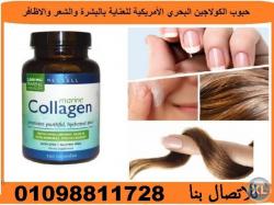 شرة والشعر
